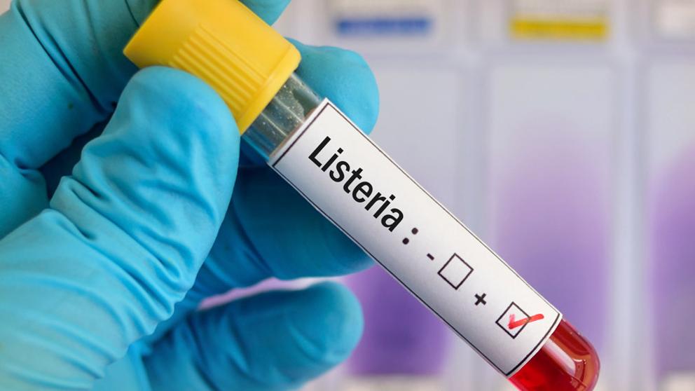 Sanidad investiga cinco posibles casos de listeriosis en la Comunitat