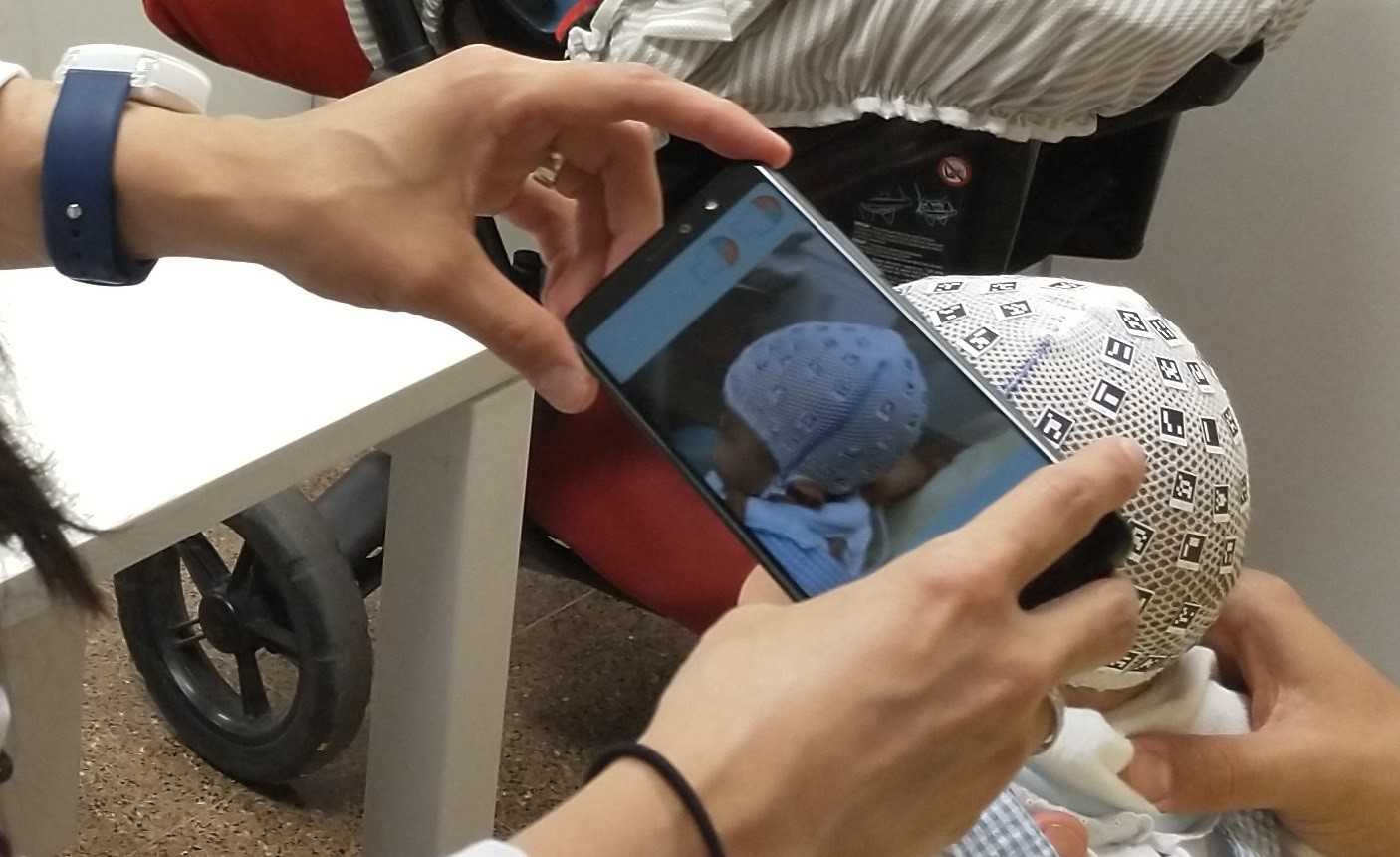 Un nuevo sistema permite medir la deformación craneal de los bebés desde el móvil sin TAC ni resonancias