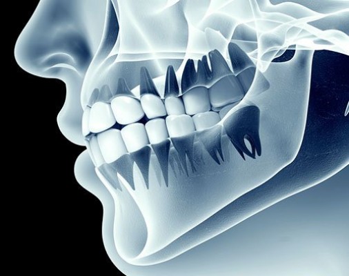 Dentaltix capta medio millón de euros en una ronda de financiación liderada por Cabiedes y Bewater Funds
