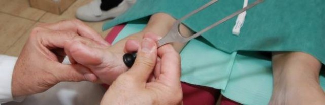 Las ampollas en los pies puede aparecer por estrés, alergias o durante el embarazo