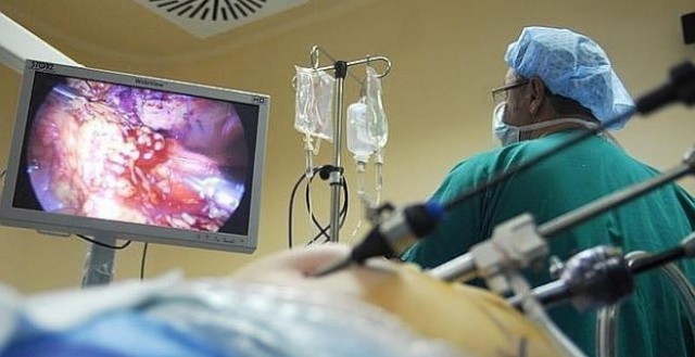 El Programa de Prevención de Cáncer de Colon permitió detectar 430 casos en la Comunitat 