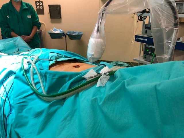 El Hospital 9 de Octubre estrena una novedosa cirugía 