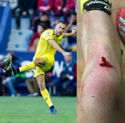 Pedraza se recupera del golpe en la rodilla y entrena con normalidad
