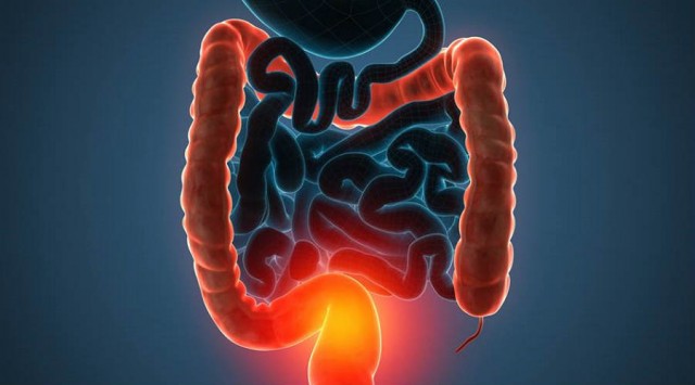 El Hospital de Alicante, referente en el manejo de la Enfermedad Inflamatoria Intestinal