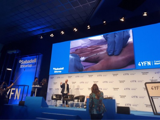 Banco Sabadell presenta un sistema de pago con un chip implantado bajo la piel
