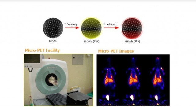 Nuevas nanomedicinas abren la puerta a un tratamiento más eficaz y menos agresivo del cáncer de próstata