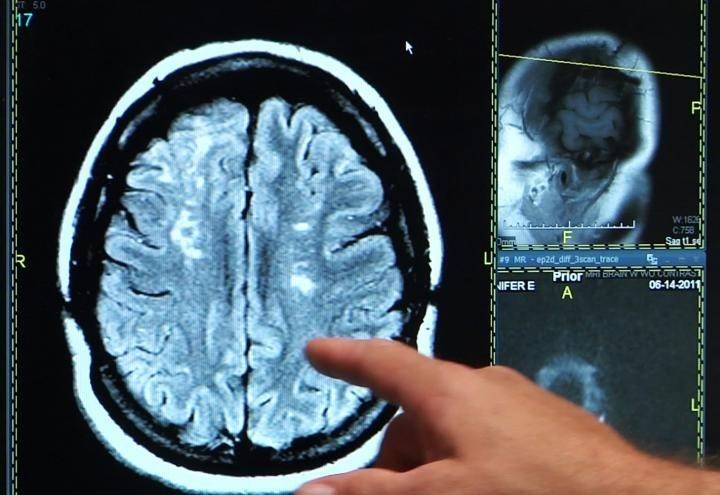 Un fallo informático dificulta el trabajo de los radiólogos en los hospitales públicos valencianos