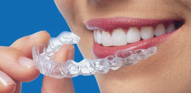 Align Technology, ortodoncia transparente que cotiza en bolsa