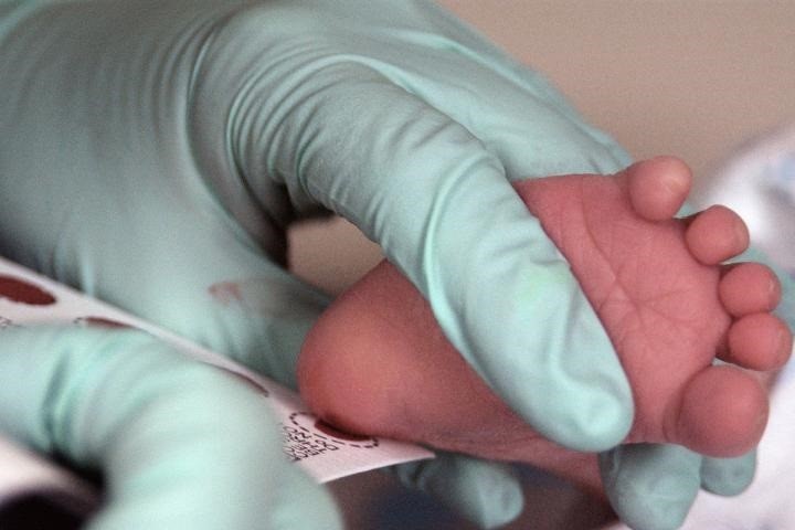Expertos piden ampliar la prueba del talón a más enfermedades