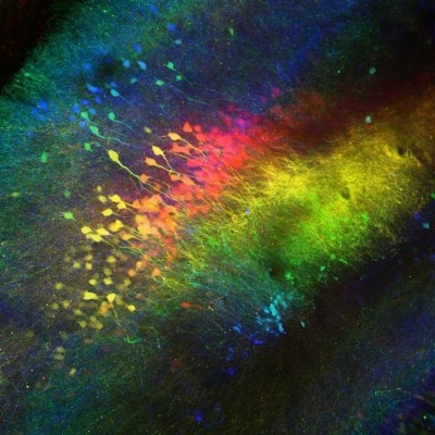 El área del cerebro que controla la memoria social también está detrás de la violencia