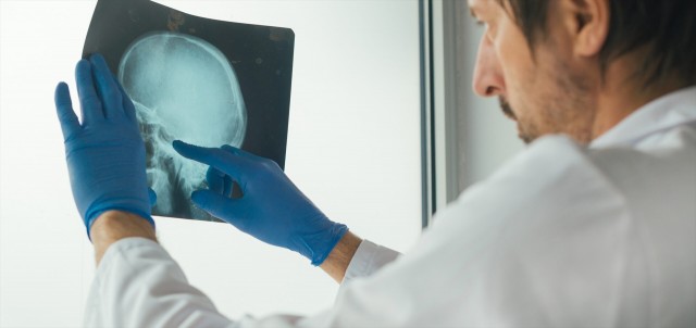 I3M (CSIC-UPV) participa en un proyecto europeo para el tratamiento de cáncer de hueso