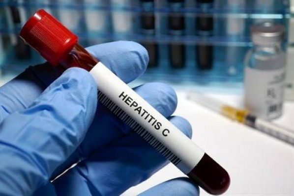 Los casos de hepatitis A en la Región aumentan un 106% en un año, hasta los 31 contagios
