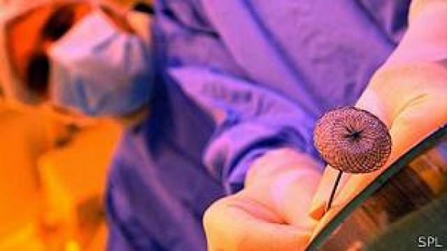 Crean un pegamento quirúrgico para unir tejidos frágiles o elásticos

