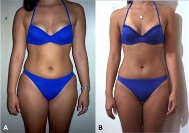 La toma de imágenes conforme se hace dieta garantiza el éxito, según un estudio