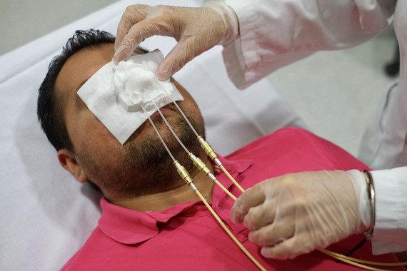 Un médico simula la aplicación del tratamiento de cáncer de piel sobre un paciente . Foto: URV - 