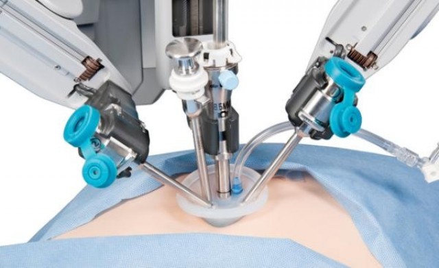 El Hospital General de València realiza la primera operación con cirugía robótica en la Comunitat