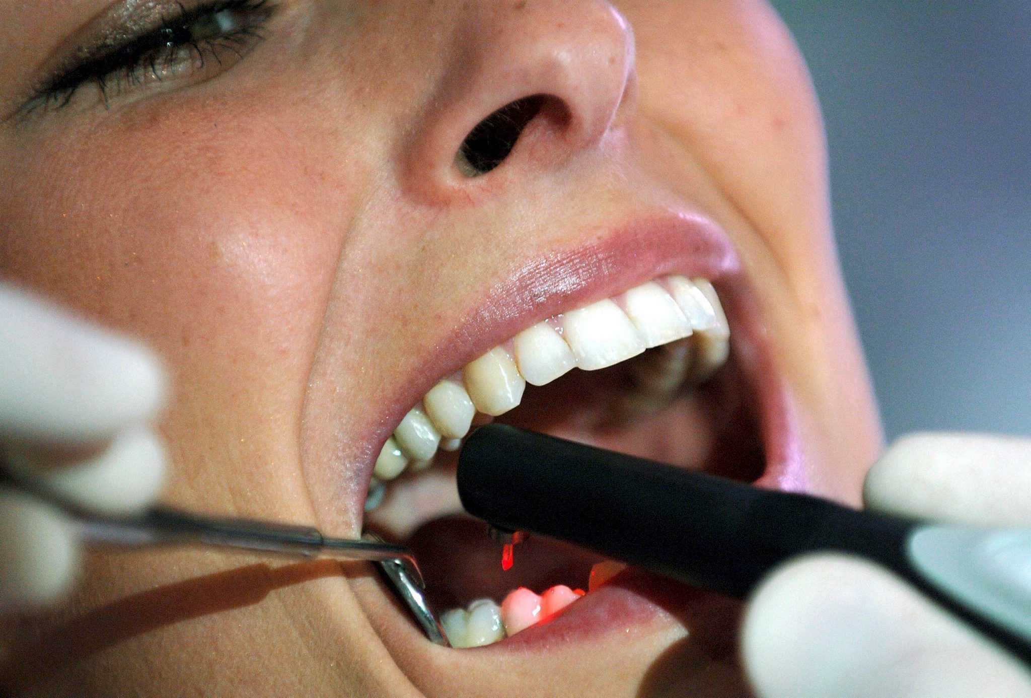 El 60% de los españoles reconoce que su salud bucodental le preocupa 