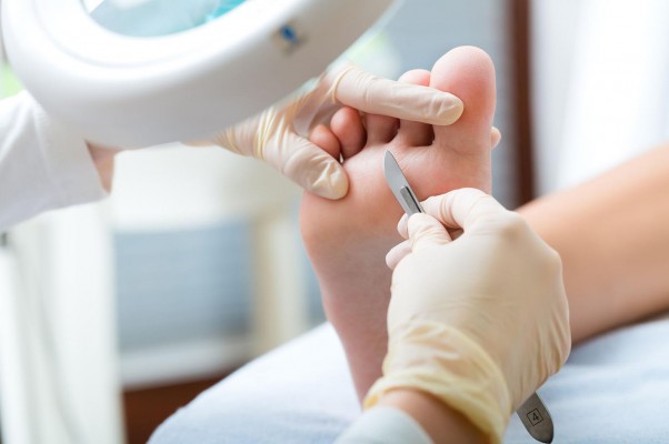 Los podólogos advierten de los riesgos de tratarse por personal no cualificado