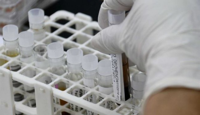 Anticuerpos muestran la efectividad para prevenir el VIH y prometen nuevos tratamientos y curación




